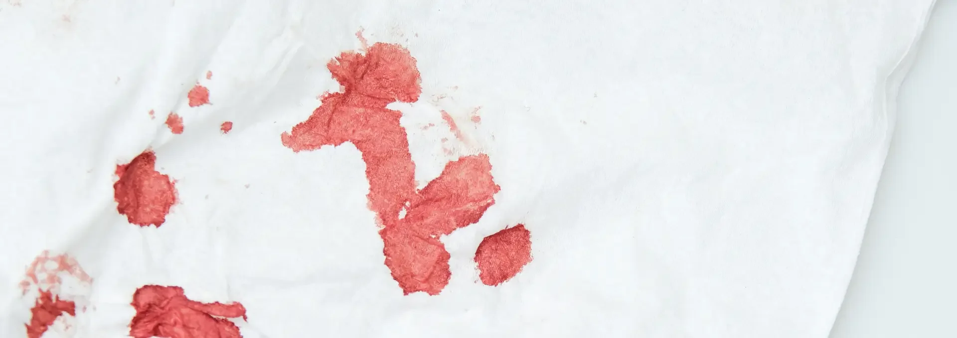 איך להוציא כתמי דם — המדריך המלא